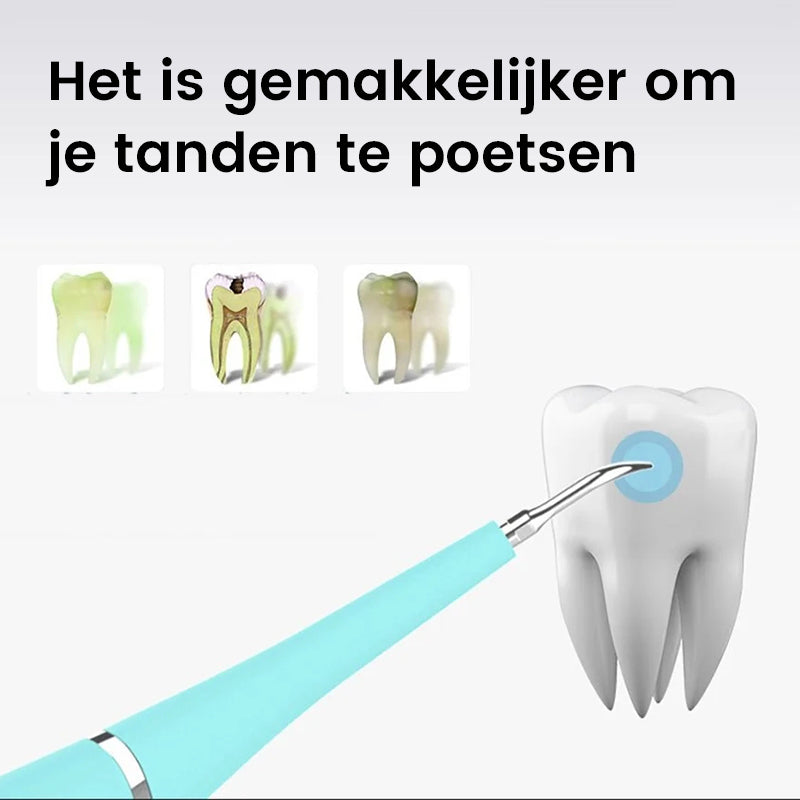 Ultrasone tandenreiniger