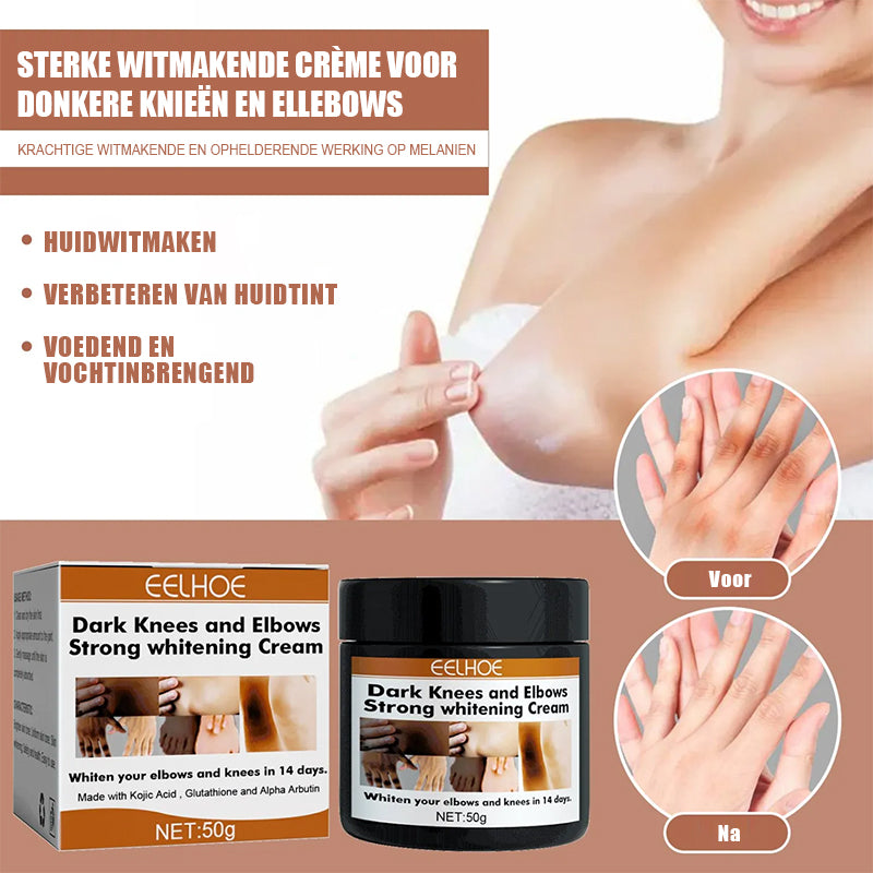 Donkere knieën en ellebogen Sterke bleekcrème