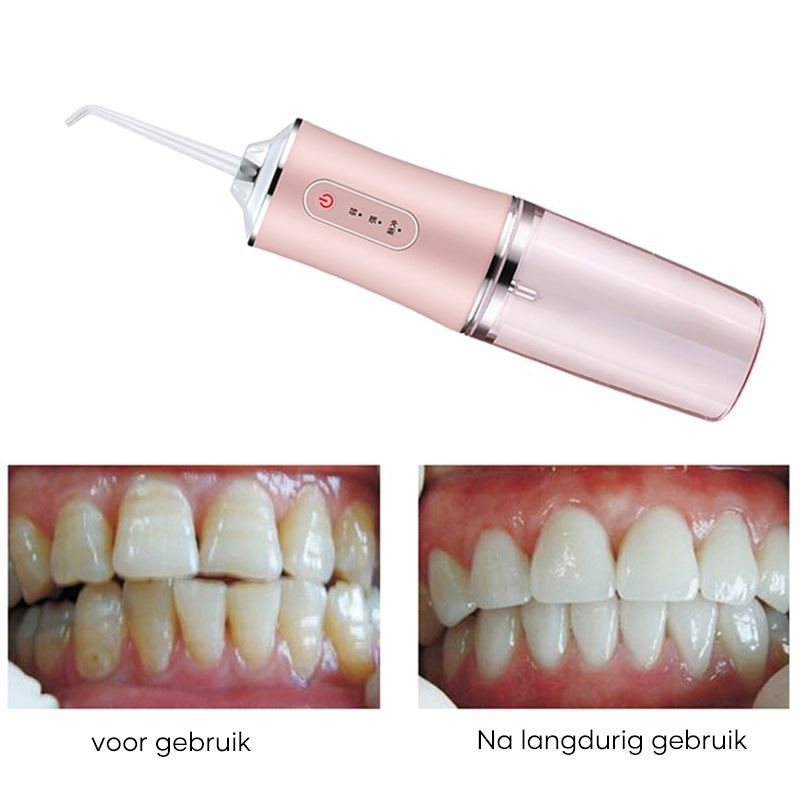 Draagbare tandheelkundige waterflosser