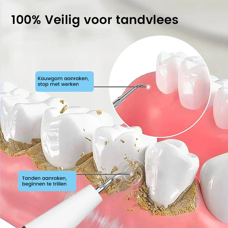 Ultrasone tandenreiniger