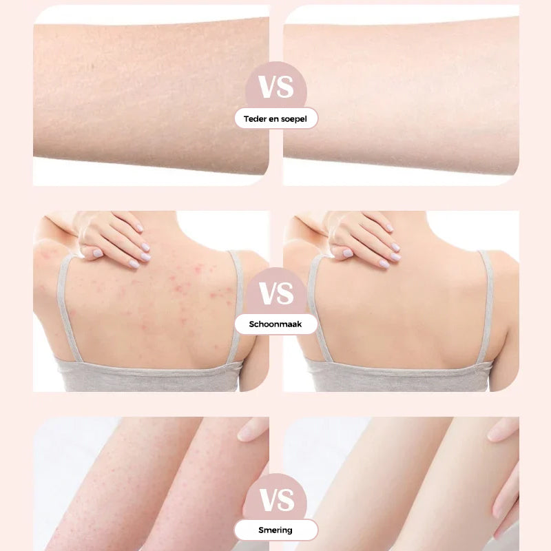 Superzachte badsponsbloem