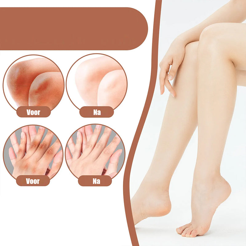 Donkere knieën en ellebogen Sterke bleekcrème