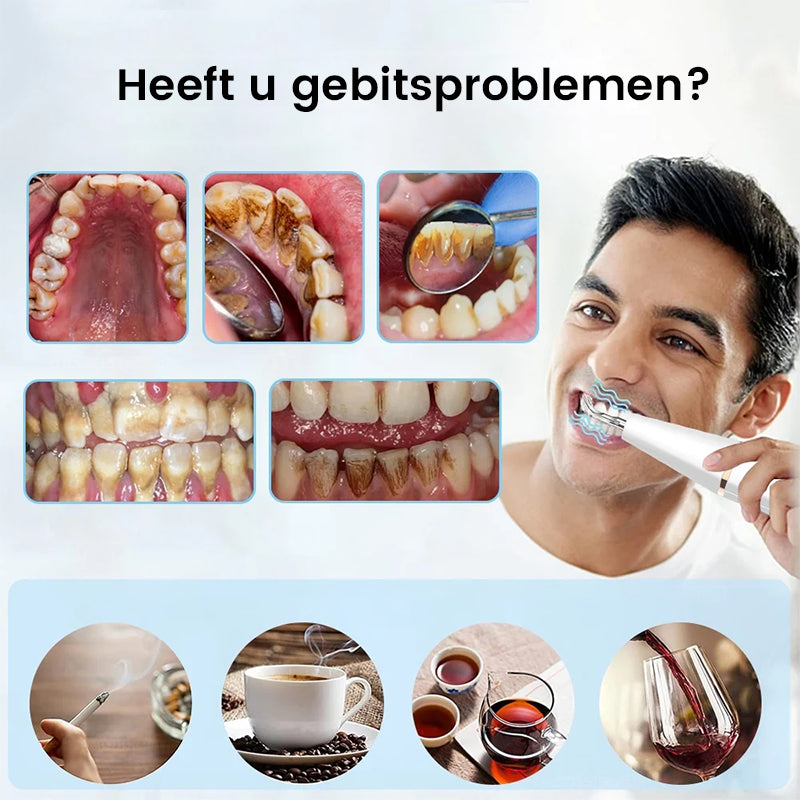 Ultrasone tandenreiniger