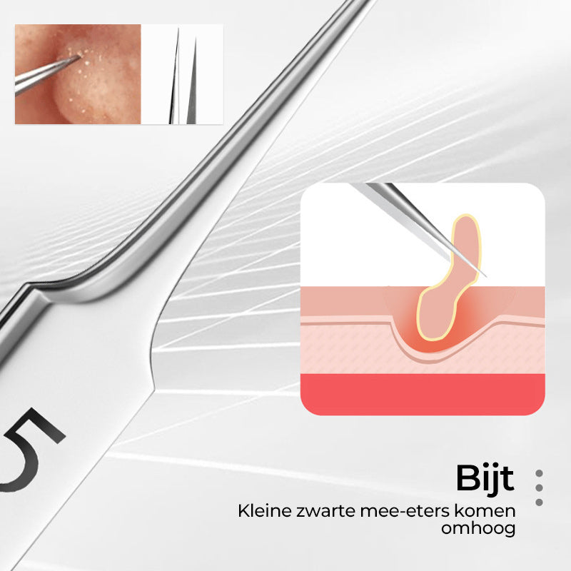 Professioneel mee-eterverwijderaar voor het gezicht