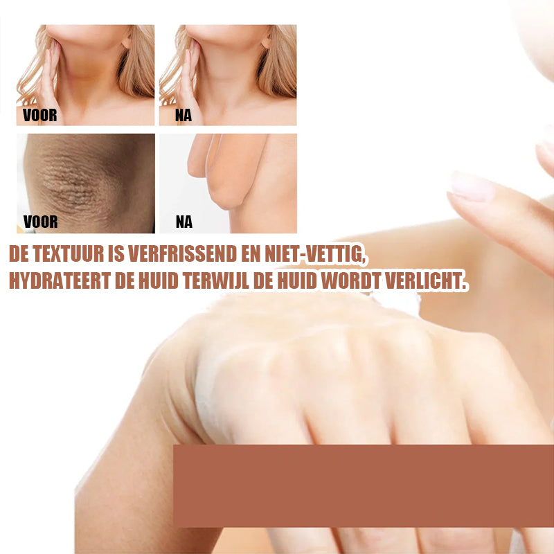 Donkere knieën en ellebogen Sterke bleekcrème