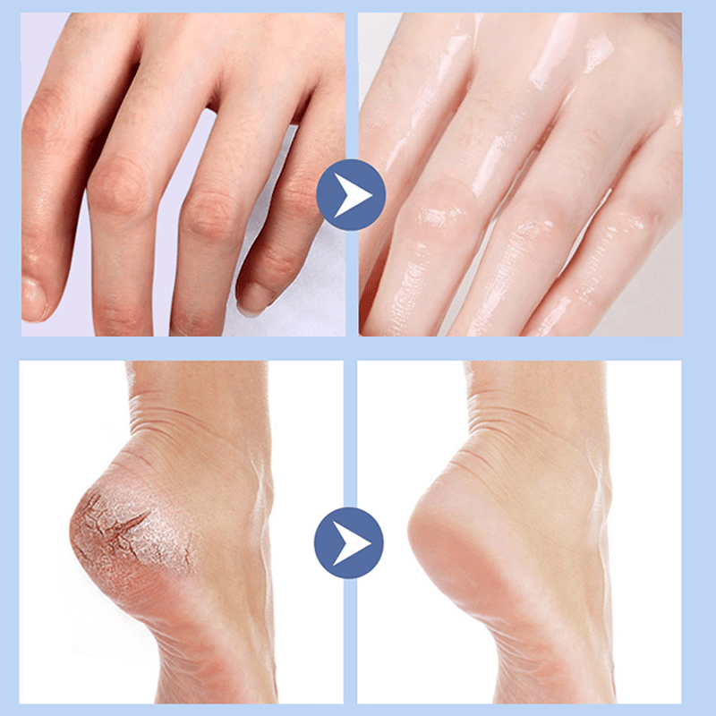 Voetverzorgingscrème