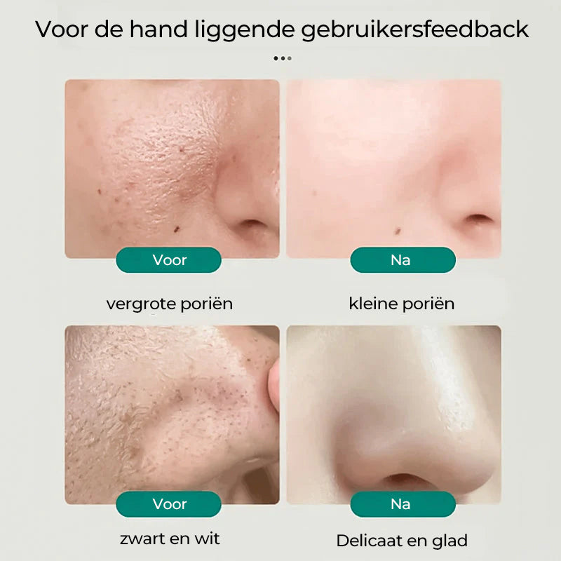 Southern X IE en niacineamide bleek Gezichtsreiniger