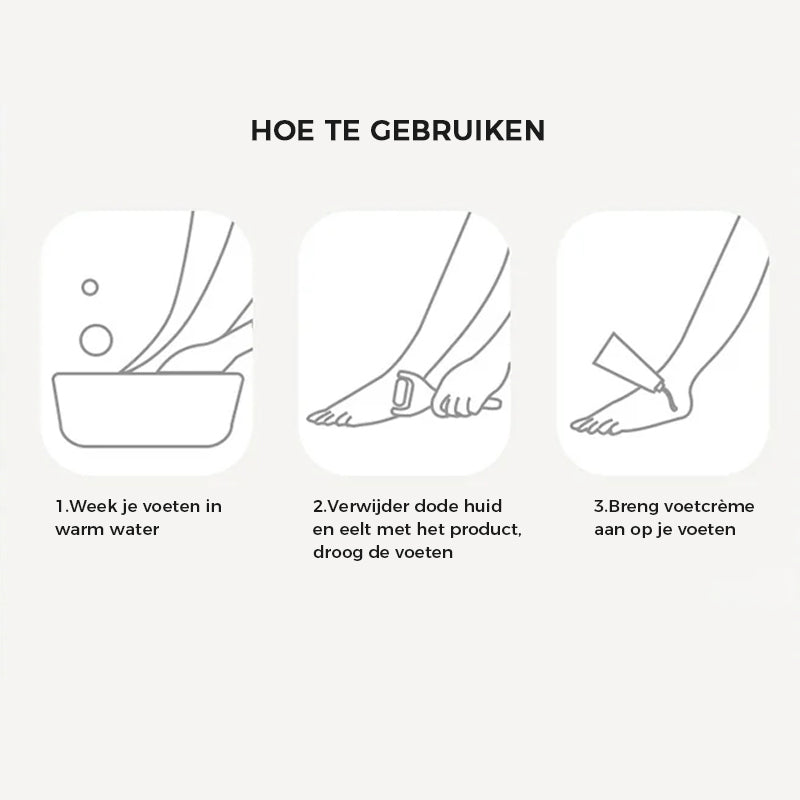 Oplaadbare elektrische voeteeltverwijderaar