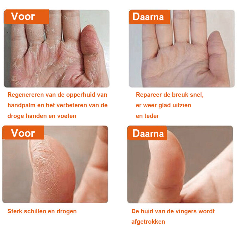 Anti-kraak wintercrème