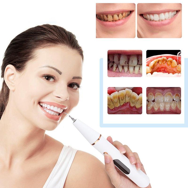 Sonic elektrische tandheelkundige scaler