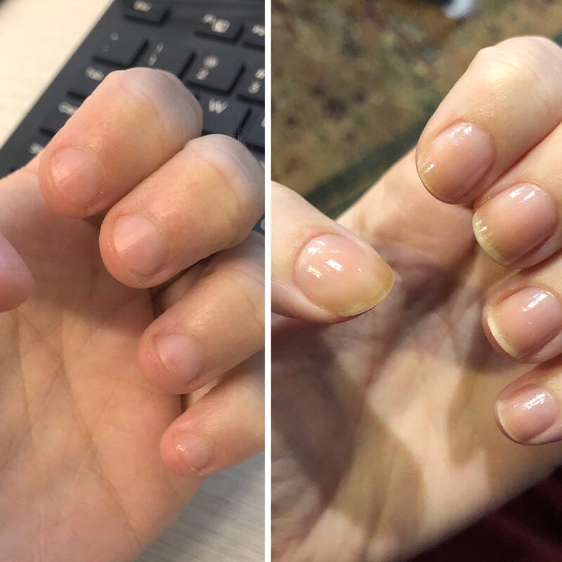 Nagel Voedingsolie Pen