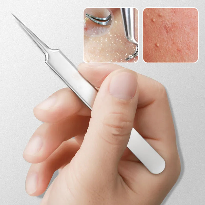 Professioneel gezichts-mee-eterverwijderaarpincet