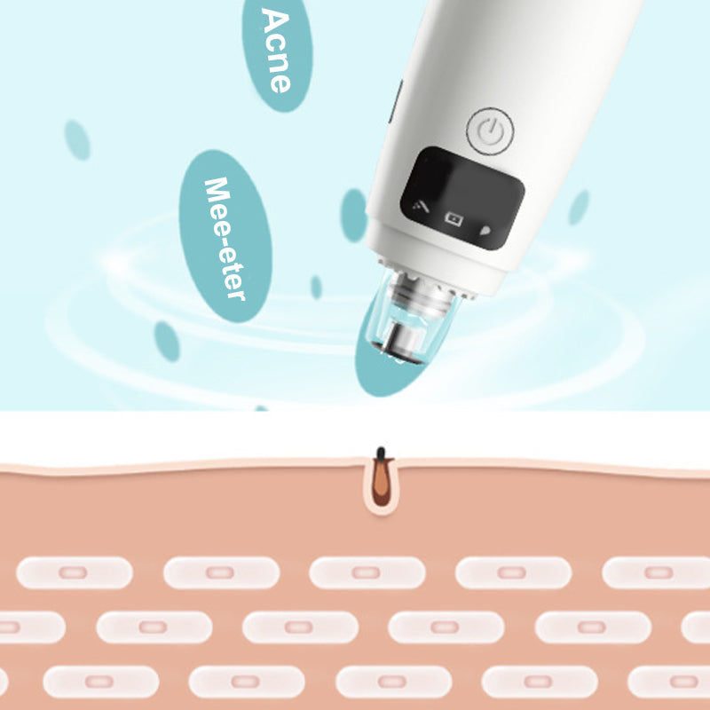 Mini Ultrasonic 2 in 1 Multi-Functional Skin Vacuum