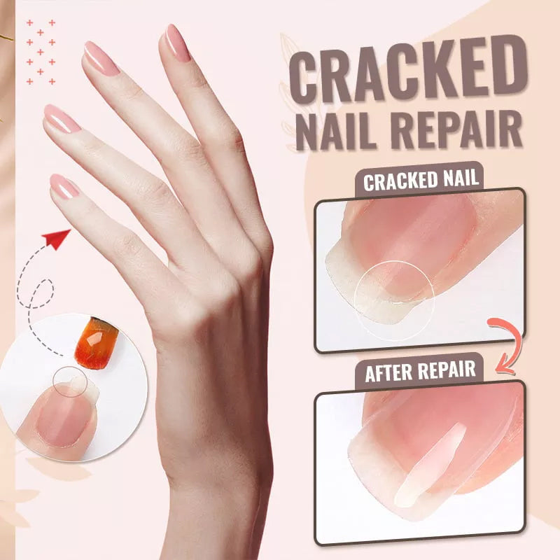 Reparatielijm voor nagelvezels