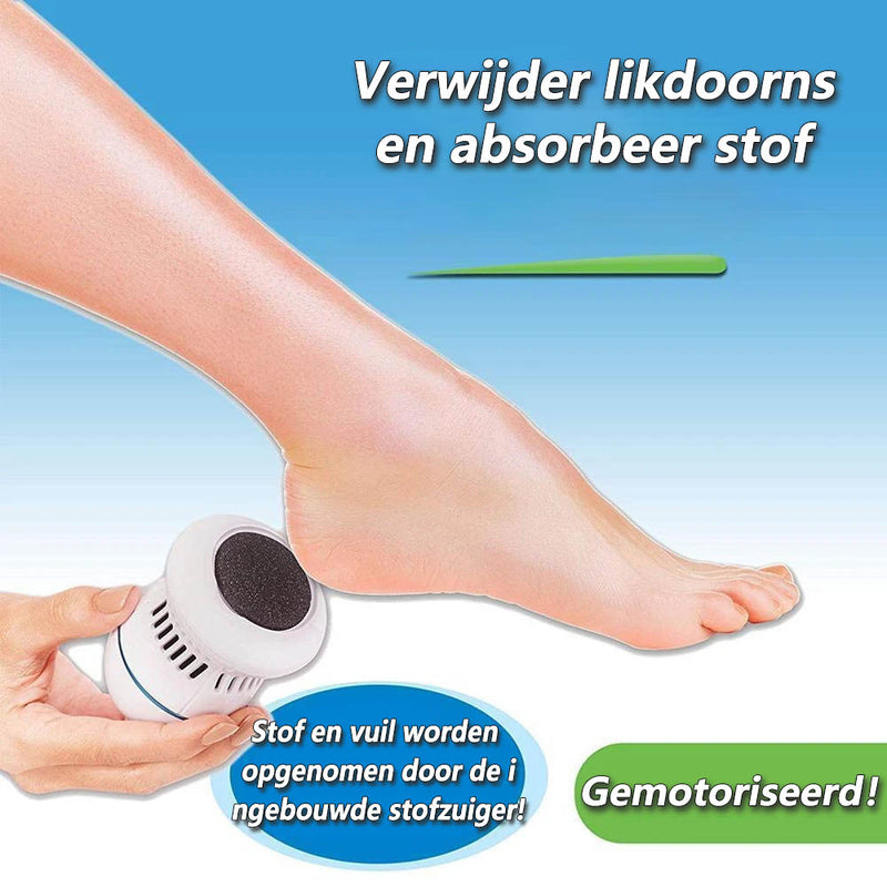 Voetvijl en eeltverwijderaar