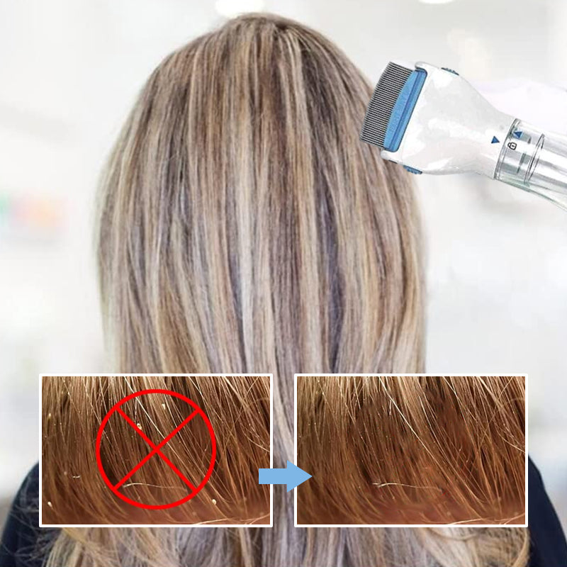 V-Comb Hoofdluizenmachine Met 3 Filters