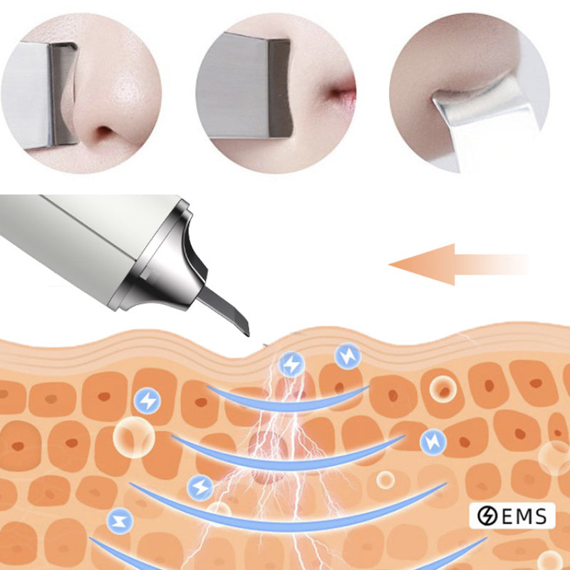 Mini Ultrasonic 2 in 1 Multi-Functional Skin Vacuum