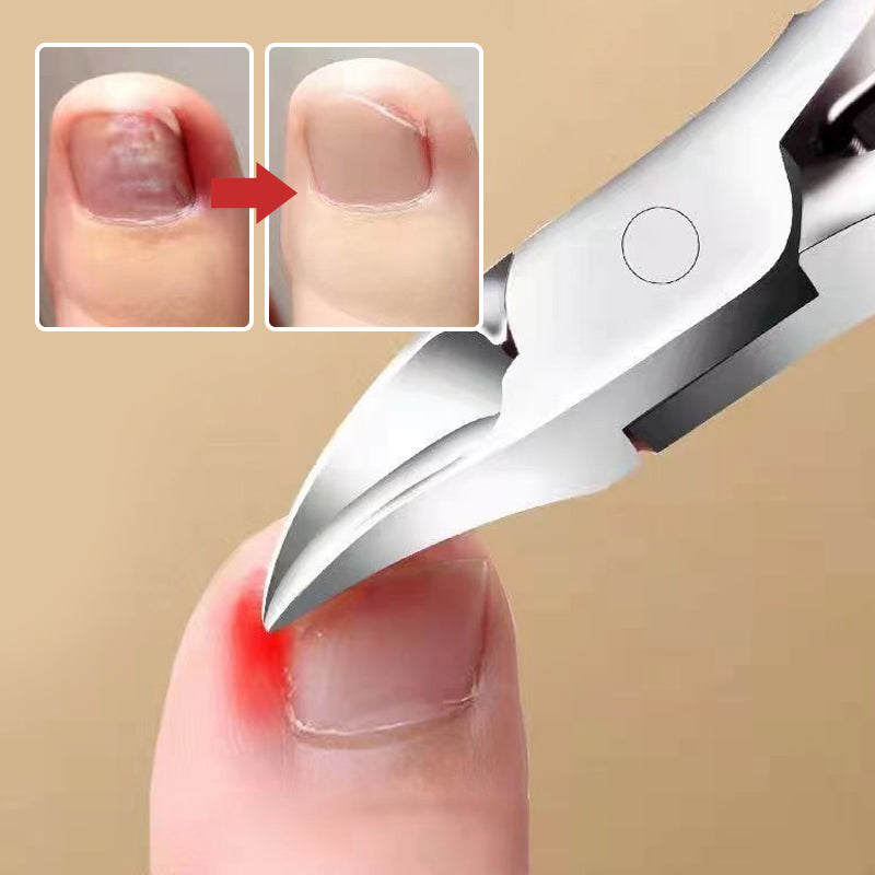 Roestvrijstalen nagelgroef olecranon clipper