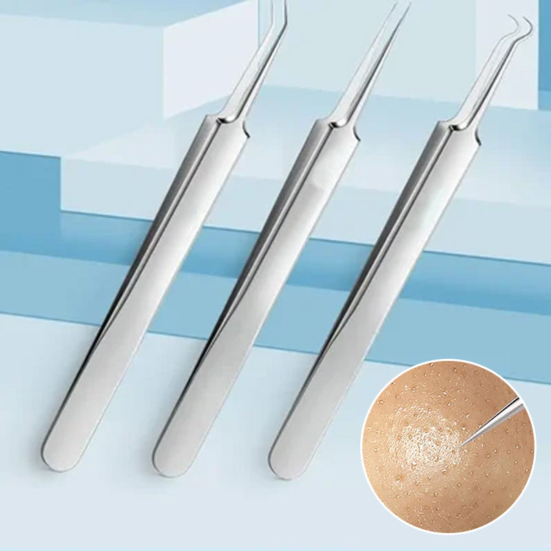 Professioneel gezichts-mee-eterverwijderaarpincet
