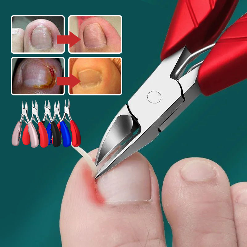 Roestvrijstalen nagelgroef olecranon clipper