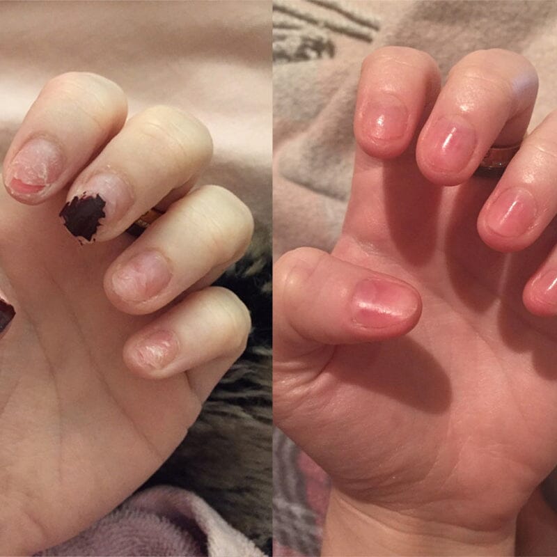 Nagel Voedingsolie Pen